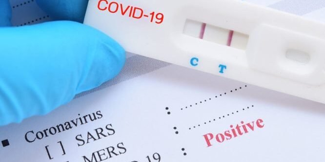 10 ερωτήσεις για την επαναλειτουργία σχολείων και self-test